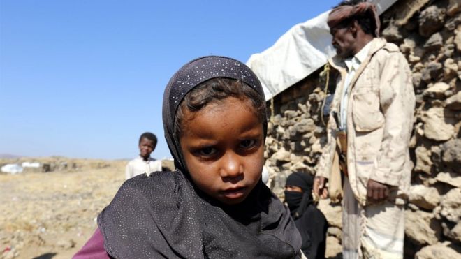 طفلة يمنية نازحة بسبب الحرب