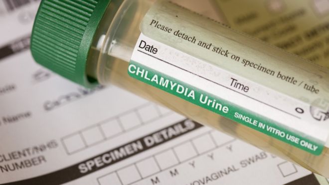 chlamydia testing file picture