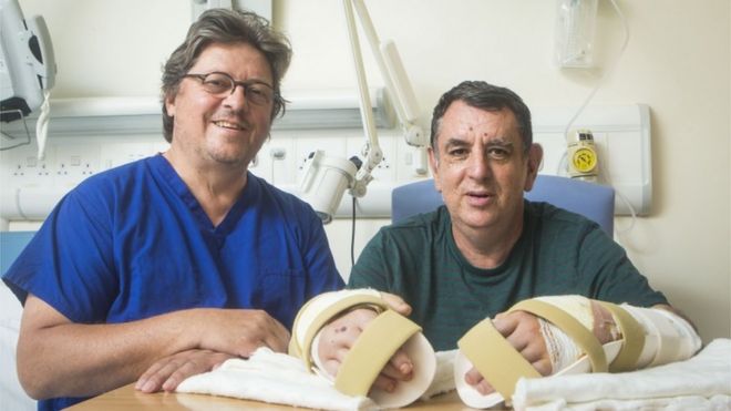 Консультант по пластической хирургии профессор Саймон Кей, который провел первую двойную пересадку руки в Великобритании в больнице Лидса, пациенту Крису Кингу