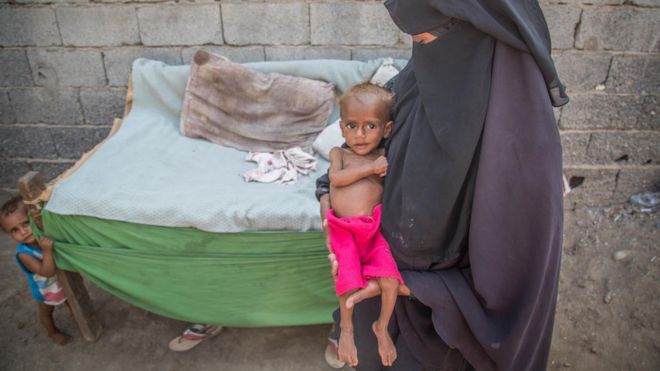 Nusair, 13 months old, in his house in Hodeidah, Yemen, with his mother Suad