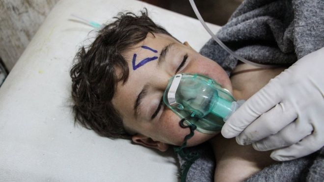 A Syrian child receives treatment after an alleged chemical attack on Khan Sheikhun in 2017