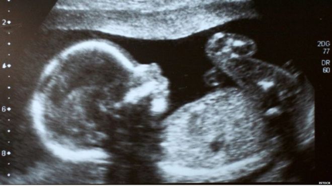 पà¥à¤°à¥à¤à¤¨à¥à¤à¤¸à¥, à¤à¤°à¥à¤à¤µà¤¤à¥, मà¥à¤¡à¤¿à¤à¤², लà¥à¤¬à¤° पà¥à¤¨, à¤à¥à¤°à¥à¤£