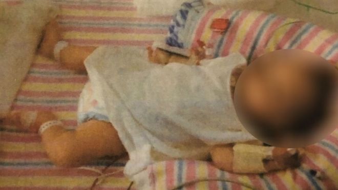 Bayi perempuan berumur 3 tahun ini hanya diberi makan gandum, kentang, dan nasi.