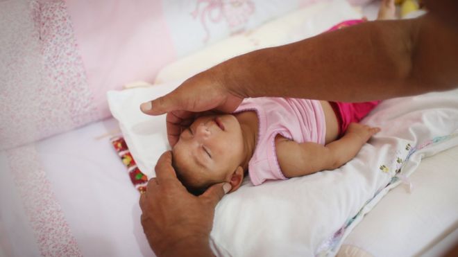 Алиса Витория Гомес Безерра, трехмесячная, с микроцефалией, помещена в ее кроватку ее отцом Жоао Батиста Безерра в Ресифи, Бразилия, 27 января