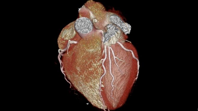 Сканирование сердца