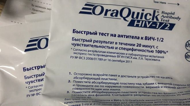 Тест на ВИЧ