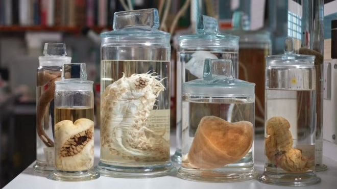 Deep-sea specimens