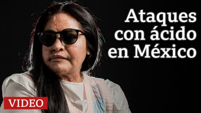Mexicanas que sobrevivieron a ataques con ácido