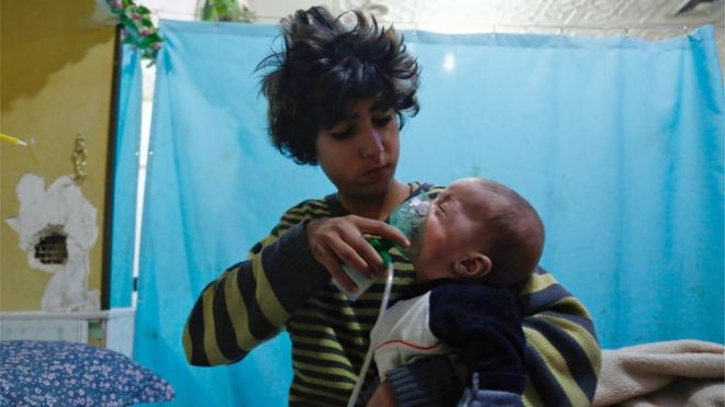 Garoto coloca máscara de oxigênio sobre bebê em hospital itinerante em Douma, Síria