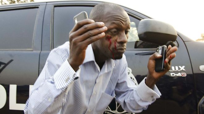 Человек, истекающий кровью после столкновений между полицией и сторонниками оппозиции в Уганде
