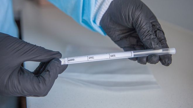 Healthworker holds a swab