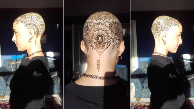 Josie without hair and with a henna tattoo on her head