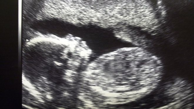 Babys, die von Scan