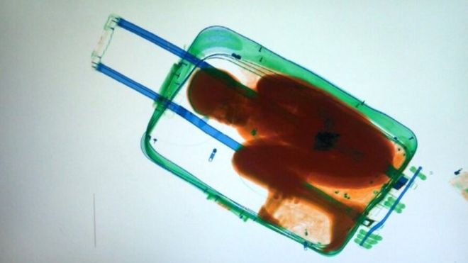 An x-ray shows an eight-year-old boy hidden in a suitcase