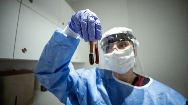 طبيبة تقوم بإعداد عينات دم من مرضى مشتبه في إصابتهم بمرض كوفيد-19.