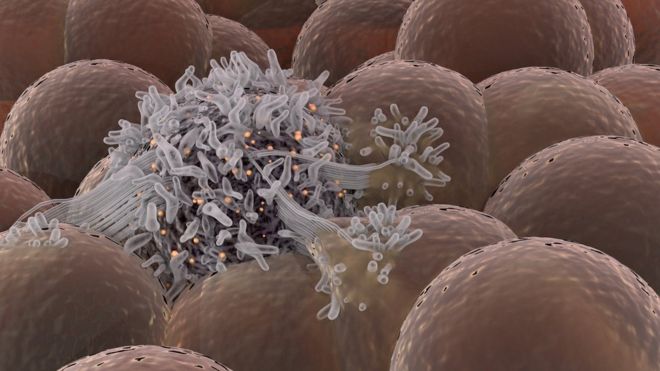 Resultado de imagem para Cientistas holandeses conseguem curar o câncer em apenas 11 dias sem o uso de quimioterapia