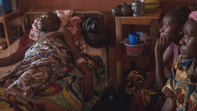 После ранения в результате взрыва гранаты 35-летний музыкант Эммануэль Нгаллос лежит на кровати в общественной больнице в Банги.