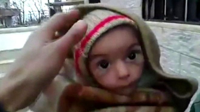 Infant in Madaya, 7 Jan