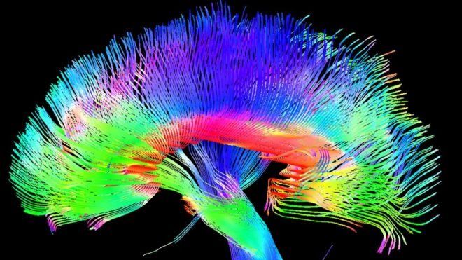 آیا واقعا مغز انسان صرفا یک مجموعه پیچیده متشکل از ماشین‌های کوچک است؟