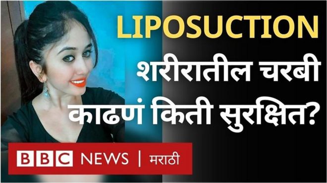 लायपोसक्शन म्हणजे काय?