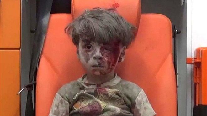 Omran con el rostro cubierto de sangre