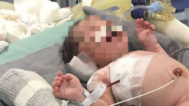 Baby Arthur was shot before he was born