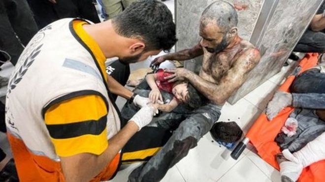 المعدات الطبية قليلة في غزة والأطباء يصارعون من أجل إنقاذ حياة المصابين في الغارات الإسرائيلية المتواصلة