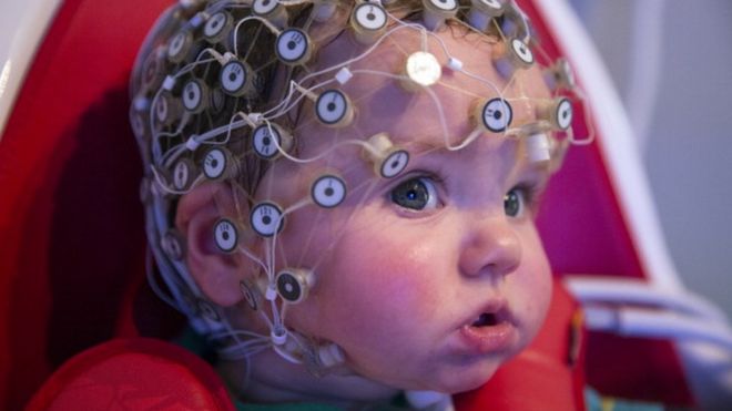 Bebé con un casco de sensores