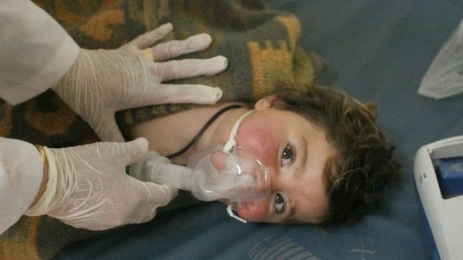 A handout photo made available by the opposition Idlib Media Center on 4 April 2017 showing what is said to be a child receiving treatment at a field hospital after an alleged chemical attack in Idlib, northern Syria