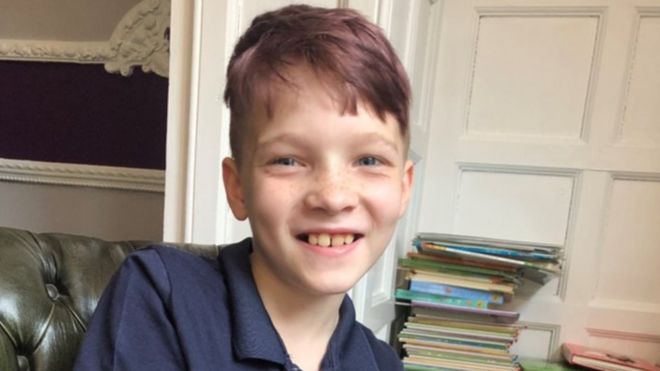 Hull motorbike crash: Boy who lost leg 'back