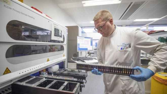 Мазки проверяются и идентифицируются в лаборатории тестирования на коронавирус в Королевском лазарете Глазго
