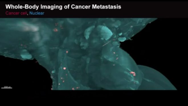 علماء يصورون بالفيديو كيف ينتشر السرطان في الجسم