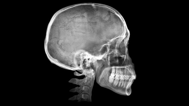 أدى تغير شكل فك الإنسان الحديث إلى تعديل الطريقة التي نتحدث بها، ما قاد إلى جعل حروف إنجليزية مثل F و V تُنطق بصورة أكثر يسرا