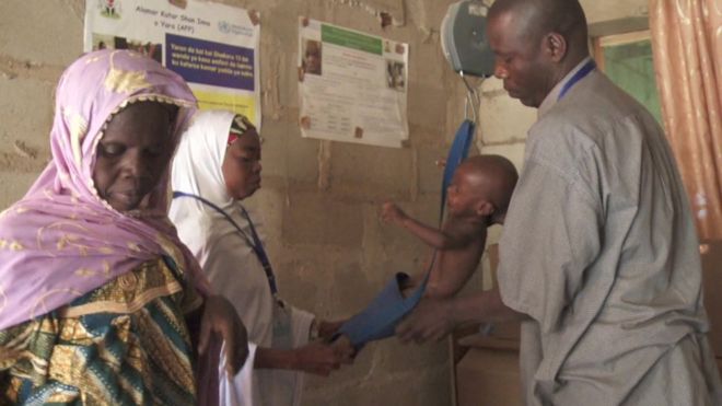 Медицинские работники взвешивают ребенка в лагере Далори в Нигерии