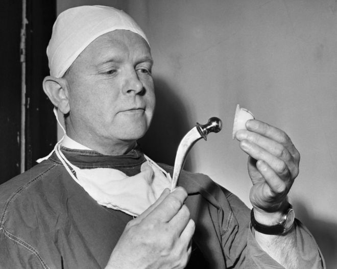 Хирург-профессор Джон Чарнли держит искусственный тазобедренный сустав из нержавеющей стали и пластика