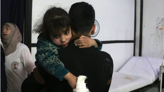 Раненый ребенок в Думе, Сирия