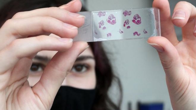 Что такое коронавирус и как он воздействует на организм?