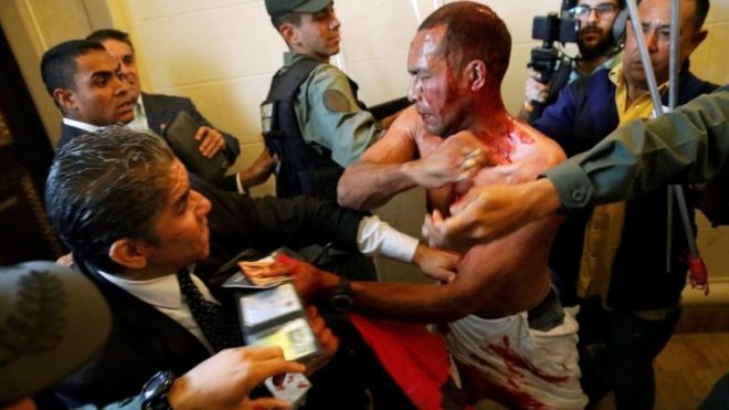 An injured government supporter tries to leave Venezuela's National Assembly after he and a group of others burst in on 5 July, 2017