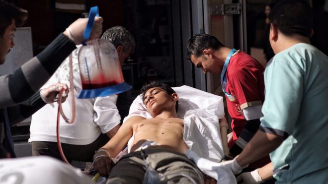 Турецкие медики приводят раненого в государственную больницу Килиса после авиаудара в северной части Сирии (15 февраля 2016 года)