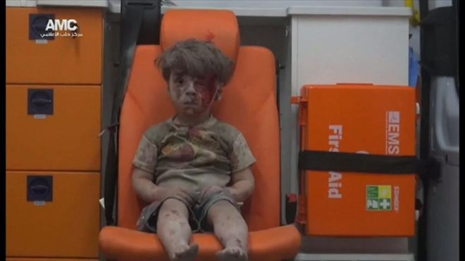 「21世紀のホロコーストだ」――シリア負傷男児手当てした医師