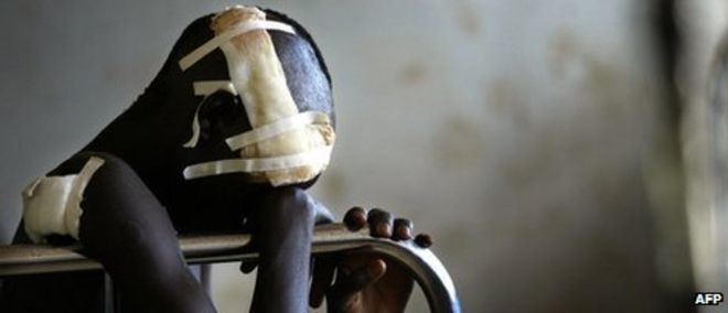 Мальчик, раненный во время нападения мятежников на севере Уганды, сидит в больнице (ноябрь 2003 г.)