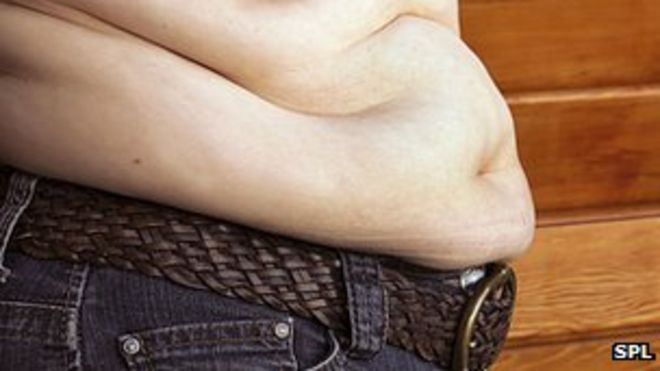 Избыточный вес человека