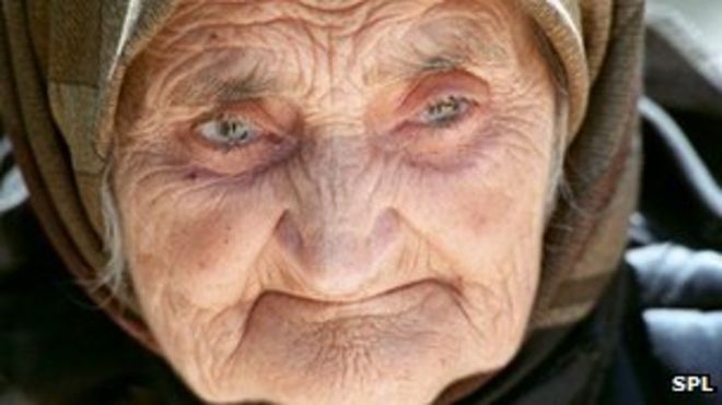 104-летняя женщина