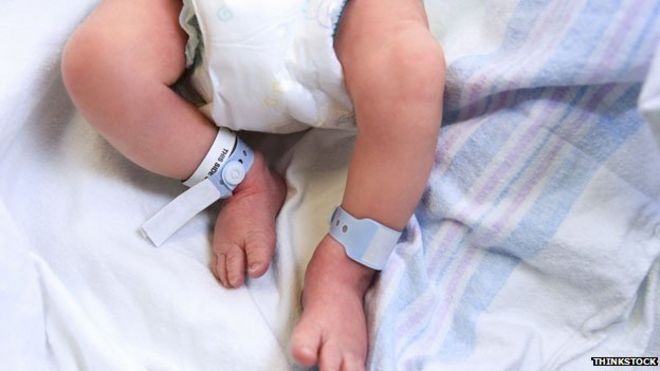 Asian baby boy circumcision photo 561