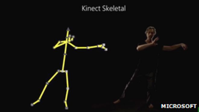 Kinect