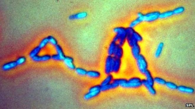 Микроскопическая картина вируса сибирской язвы крупным планом