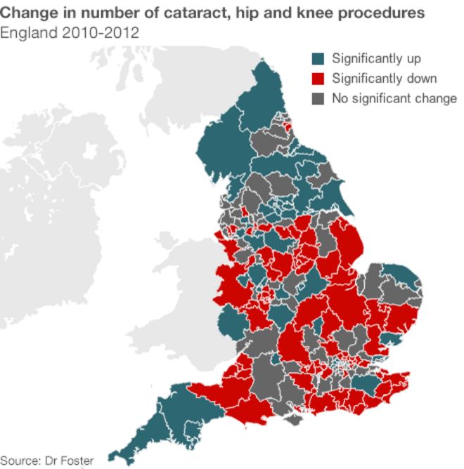 Карта, показывающая изменение количества катаракт, операций на бедре и колене между 2010 и 2012 годами