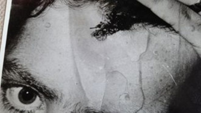 Фрагмент фотографии, показывающей травму головы Рэя Райли
