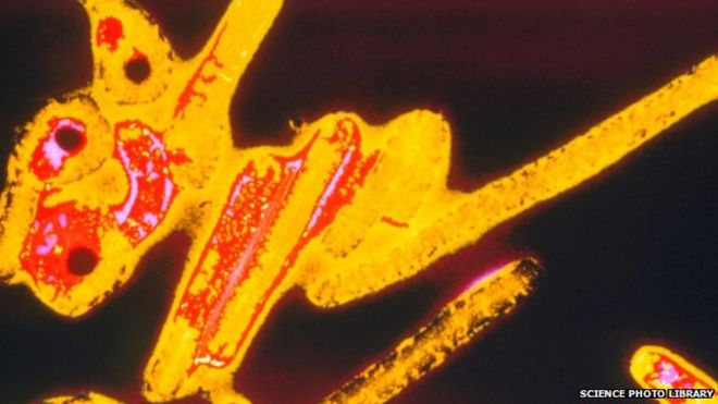 Вирус Эбола, видимый через электронный микроскоп