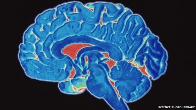 Цветное изображение компьютерной томографии головного мозга